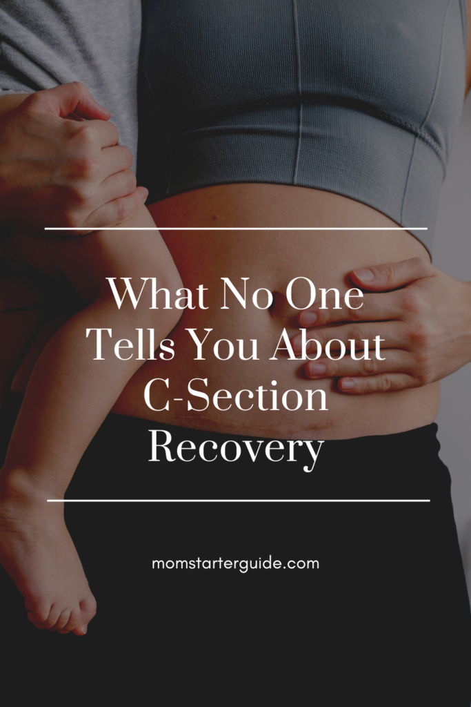 what no one tells you about c section recovery